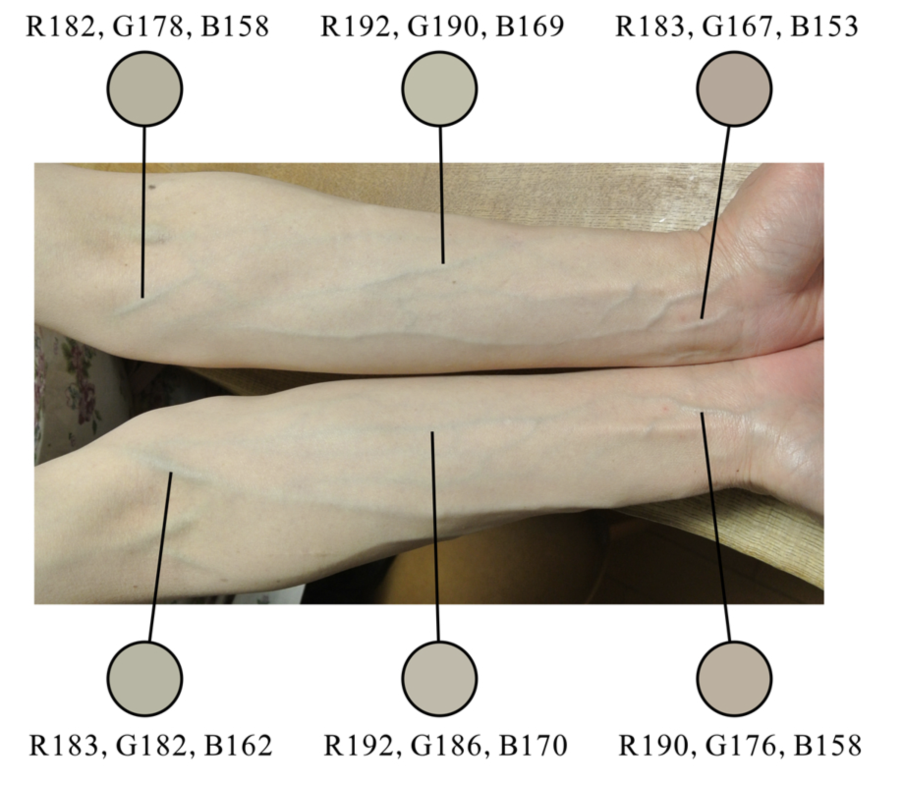 slightly red veins that look blue